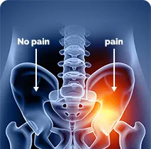 Pelvic Grindle Pain